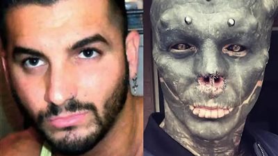 حوّل نفسه لكائن فضائي فقطع أنفه وشفتيه.. فرنسي يجري تعديلات على وجهه (صور)