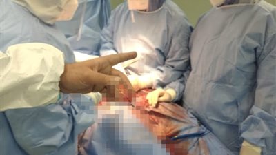 مصابة بكورونا تضع مولودها في ولادة قيصرية بالشرقية (صور)