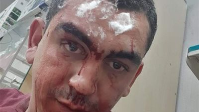 تحديد هوية المعتدين على صيدلي مصري في السعودية (صور)