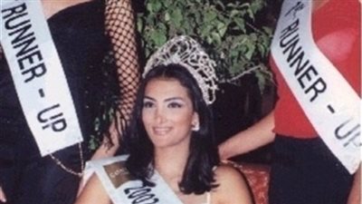 تغير ملامح حورية فرغلي من ملكة جمال مصر إلى حادثة شوهت وجهها