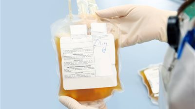 مديرة بنك الدم بالمنوفية: لأول مرة تقديم خدمة سحب بلازما المتعافين من فيروس كورونا 