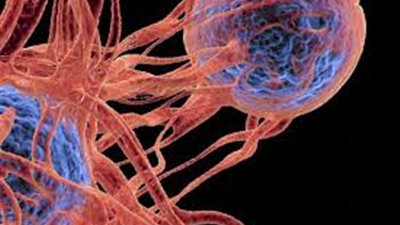 استشاري: قلة النوم لها مضاعفات سلبية على المناعة لمريض السرطان (فيديو)