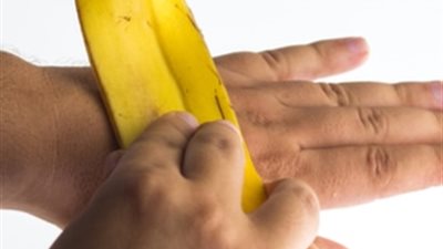 تنظف الأسنان وتقلل حب الشباب.. تعرف على فوائد قشور الموز 