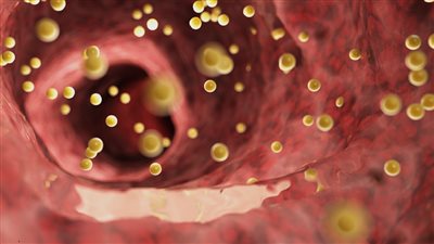 نصائح بسيطة لخفض نسبة الكولسترول