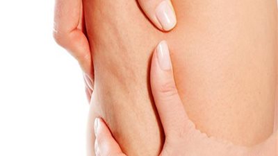 هذا الشاي مفعوله سحري في القضاء على السيلوليت