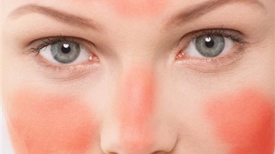 كيف تعرف أن بشرتك حساسة؟