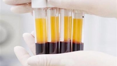 وكيل صحة النواب: قانون عمليات الدم وتجميع البلازما يتيح تكنولوجيا غير مسبوقة في مصر