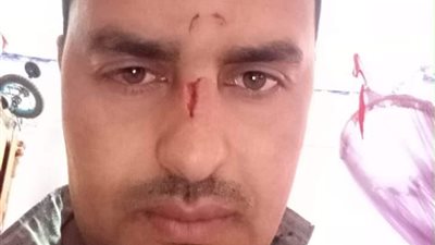 الكلاب الضالة تعقر 6 أشخاص بطريق مزلقان زكي بطوخ