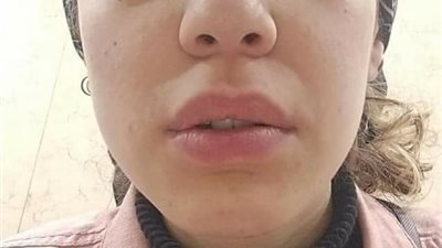 واقعة اعتداء وتحرش بفتاة في المنتزه تتحول إلى ثورة غضب على 