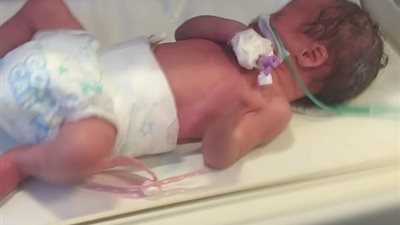 بين الحياة والموت.. أهالي طفل بالمنيا يستغيثون بالمسؤولين لعلاجه: 