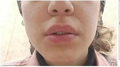 فتاة واقعة التحرش بشرق الإسكندرية تروي لـ