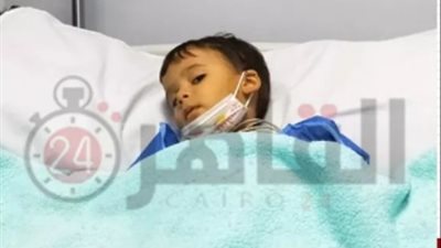 أستاذ جراحة يكشف آخر تطورات الحالة الصحية للطفل 