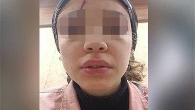 فتاة واقعة التحرش بالإسكندرية: إخلاء سبيل المُتحرش أصابني بصدمة