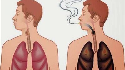 إذا كنت مُدخِّن.. كيف تُنظف رئتيك؟