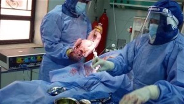 عملية ولادة