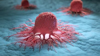 تعرف على أخطر أنواع السرطان وأكثرها شيوعًا