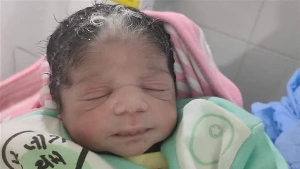 ولادة طفلة بخصلة