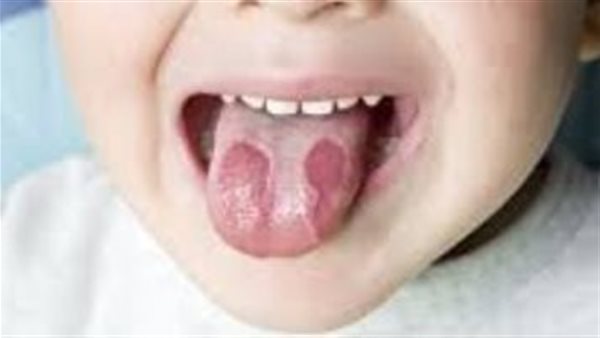 نصائح لتقليل آلام