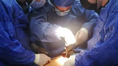 فريق طبي بجامعة حلوان ينجح في تركيب قسطرة لمريض يعاني من تمدد كبير بالشريان الأورطي