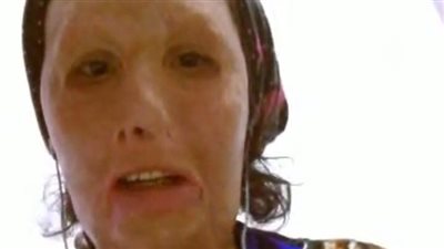 امرأة من ذوي الاحتياجات الخاصة تستغيث بالرئيس لزيادة معاشها والتكفل بعلاجها (فيديو)