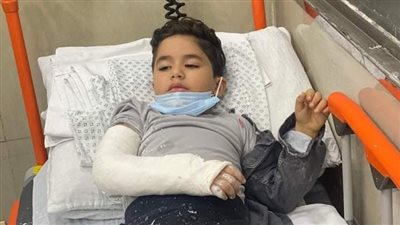 انفجار هاتف أيفون يتسبب في اندلاع حريق وكسر ذراع أحد الأطفال بالمعادي (صور)