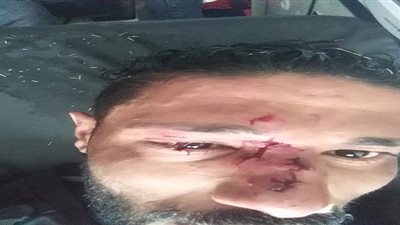 بعد كسر أنف الحارس.. إلغاء مباراة كوم حمادة والزعفران بالدرجة الثالثة (صور) 