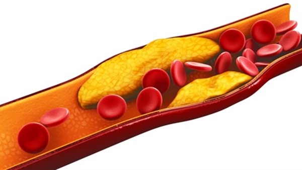 نصائح لتقليل الكوليسترول