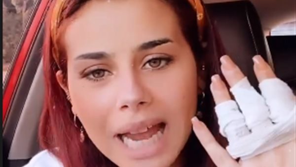 اصابة منة عرفة بحروق