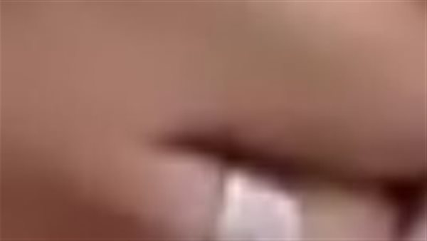 طفل عقره كلب