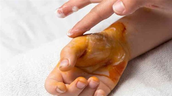  أهم الإسعافات الأولية