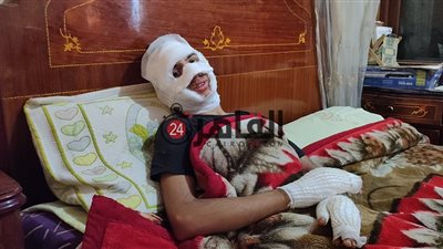 أول الناجين من حريق مصنع العبور لـ