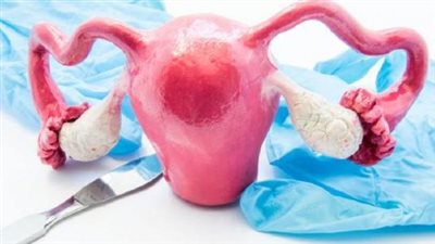 ما التأثيرات الناتجة عن إجراء استئصال الرحم؟