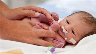 الملوثات الهوائية قد تؤدي إلى الولادة المبكرة