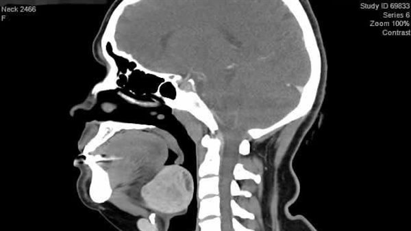 صورة للعملية