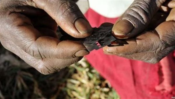 ختان الإناث