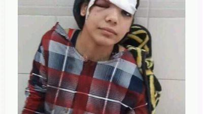 فشل في اغتصابها فمزق جسدها.. القصة الكاملة للاعتداء على فتاة الساطور بـ مطروح .. فيديو 