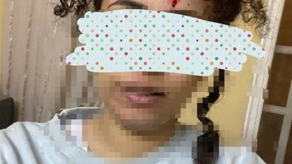 الاعتداء على فتاة