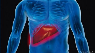 ما هي أعراض مرض الكبد الدهني وطريقه علاجه؟