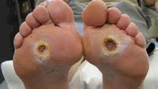  أسباب حدوث مشكلة