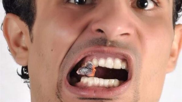 الشاب الخارق