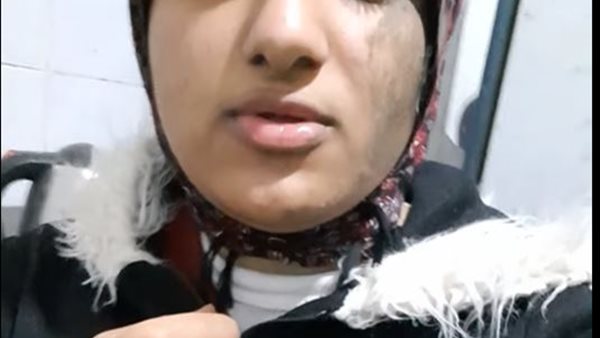 المجني عليها