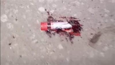 يُهدد بنشر الأوبئة.. معمل تحاليل يتخلص من عينات الدم في الطريق العام بالشرقية (صور وفيديو)