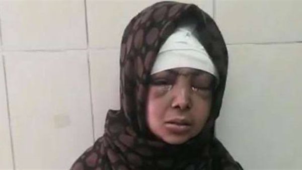 المجني عليها