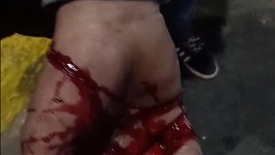 نباش يعتدي على سائق وعامل نظافة بسلاح أبيض في الإسكندرية