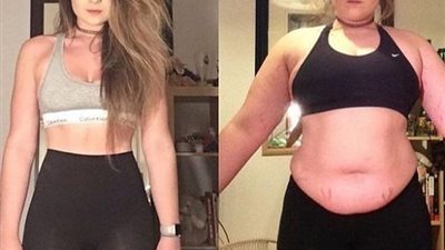 اضطرابات في الهرمونات ومشكلات صحية.. أسباب ثبات الوزن مع الرجيم 