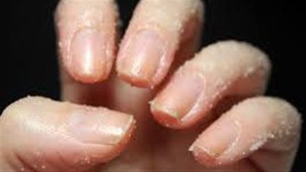  طريقة التخلص من