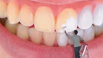 3 علاجات منزلية لتبييض اصفرار الأسنان