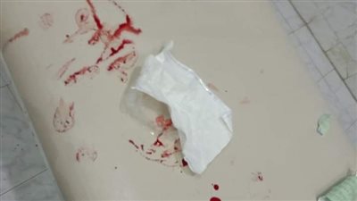 القصة الكاملة لاعتداء مجهولين على طاقم تمريض مستشفي التل الكبير 