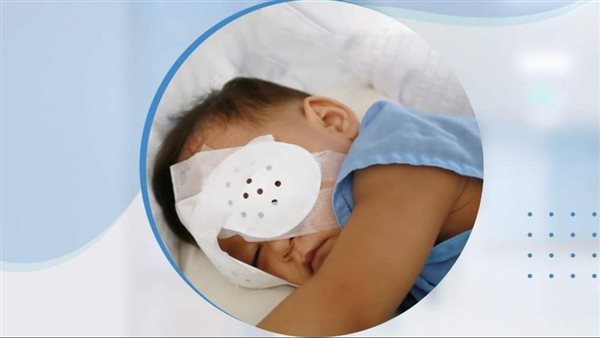 جانب من الجراحة 