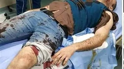 بعد حبس غفير الفيلا.. ضابط التجمع يعلن قرار جديد بشأن تعرضه للهجوم من الكلاب (صورة)